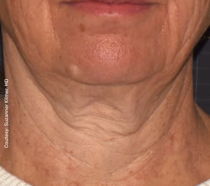 תמונה של אישה לפני הטיפול