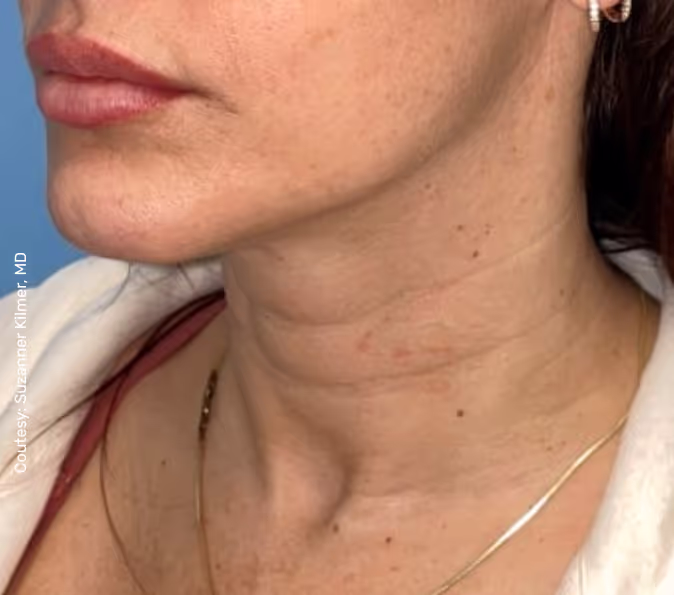 תמונה של אישה לפני הטיפול