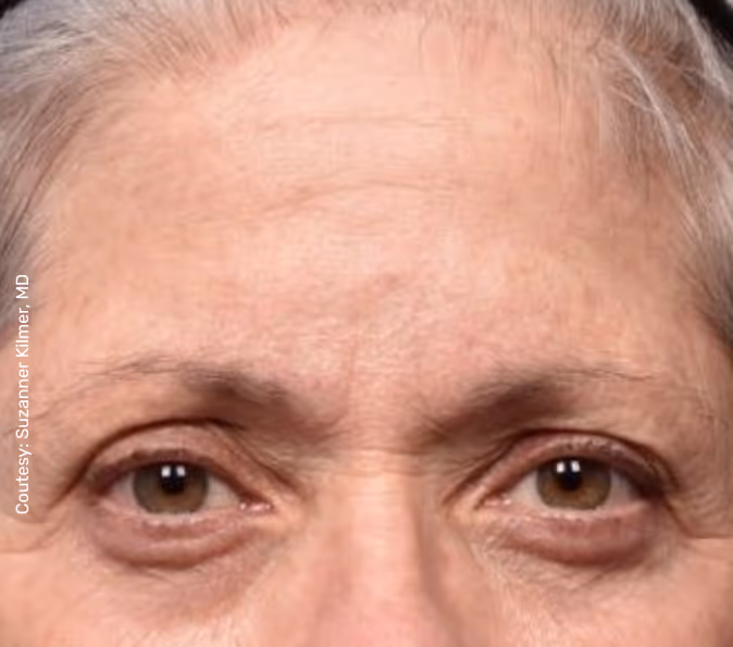 תמונה של אישה לפני הטיפול